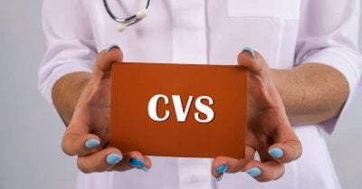 chorionic villus