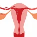 weeks pregnant