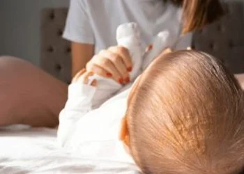 cradle cap