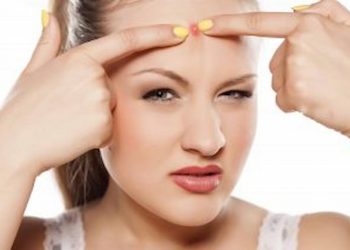 acne during pregnancy