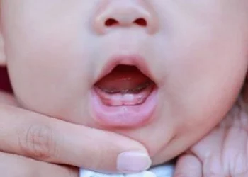 teething symptoms