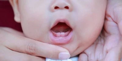 teething symptoms