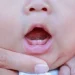 teething symptoms