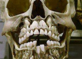 Child's Skull With Teeth