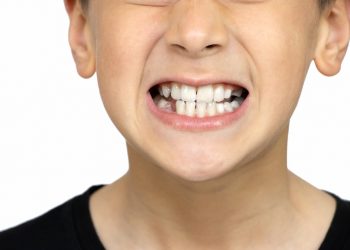 Teeth Grinding In Toddlers And Children