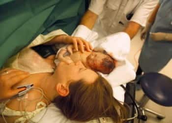 c section reduction