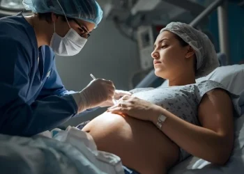 epidurals may affect breastfeeding