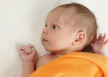 baby eczema