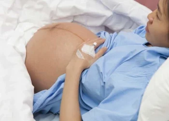 c section myths