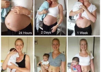 Postpartum Body