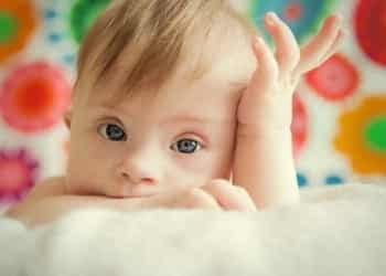 Breastfeeding A Down Syndrome Baby