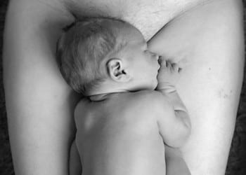 c section scar photographer