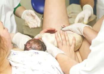 postpartum haemorrhage