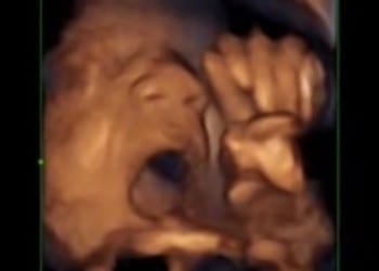 babies singing ultrasound