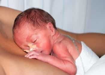 kangaroo care preemie