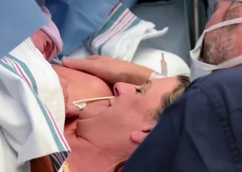Revolutionise C Sections