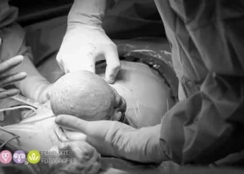 The Moment Babies' Heads Are Born