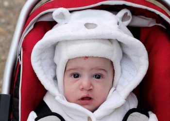 breastfeeding cleft lip palate