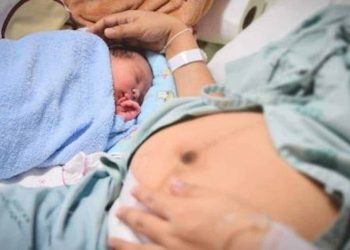 c-section