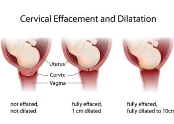 dilation of the cervix