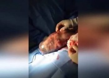 Amazing Video Shows Baby Born In Amniotic Sac