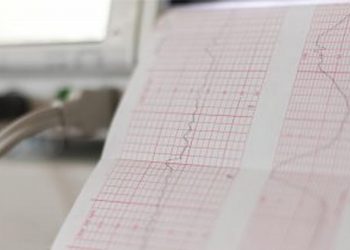 Babys Heart Rate During Labour Whats Normal And Whats Not