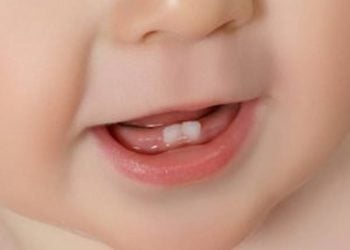Things Your Babys First Teeth Are NOT Telling You