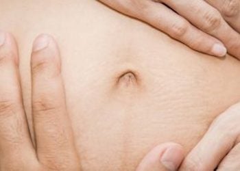 Diastasis Recti How To Fix Ab Separation During Pregnancy