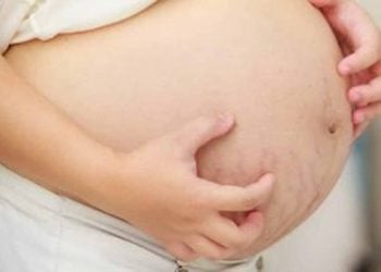 Obstetric Cholestasis – Everything You Need To Know