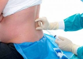 Where Does An Epidural Go Understanding Epidurals Part