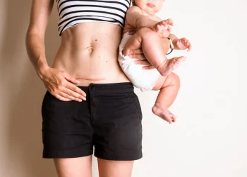 after a caesarean