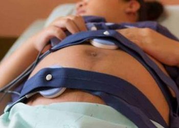 Do Inductions Increase The Risk Of C Section