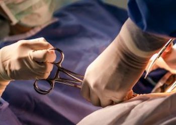 Australia's c-section rate