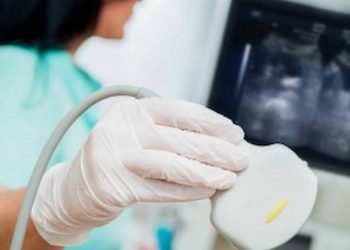 Thoughts I Had During My First Ultrasound Scan