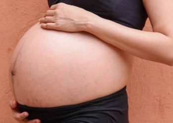 Episiotomy vs Tearing Which One Is Better