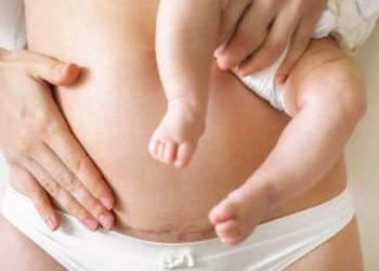 Things Women Should Know About VBAC