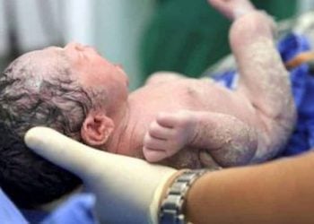 Doula Shares Amazing Photo Of Rare Face First Birth