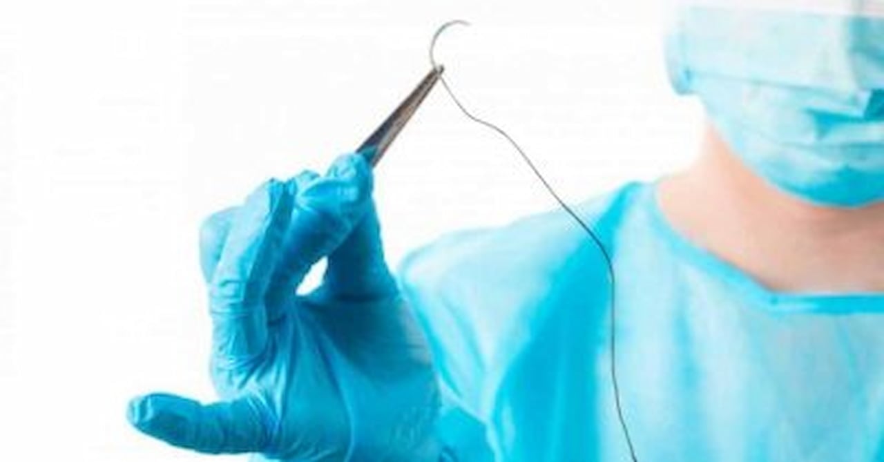 The Husband Stitch – Myth Or Fact?