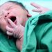 Birth Interventions Lead To Long Term Health Problems For Children Study Says
