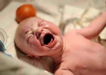 Breastfeeding after c-section