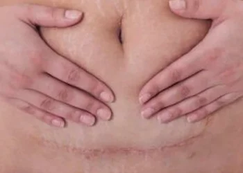 wait between c section and VBAC
