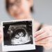 12 Week Ultrasound