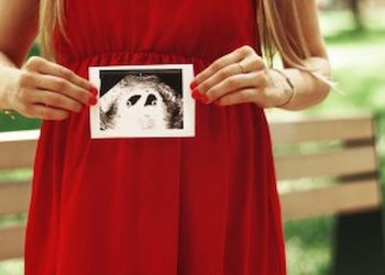 Identical Twins Fascinating Facts About Twins