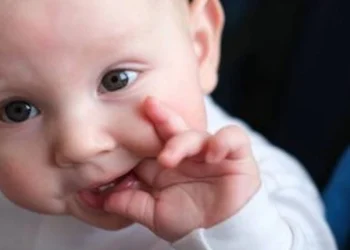 Teething Rash