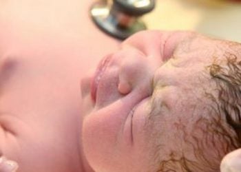 Meconium Aspiration Treatment And Long Term Effects