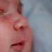 newborn eye discharge