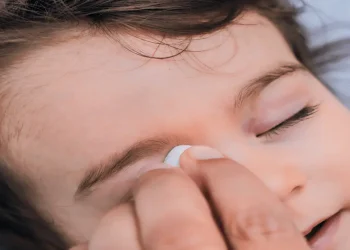 newborn swollen eyes
